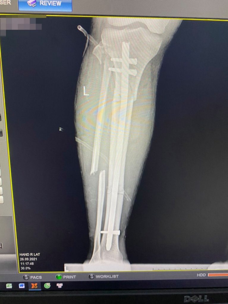 243354553 1101232073741948 8148057815591279670 N