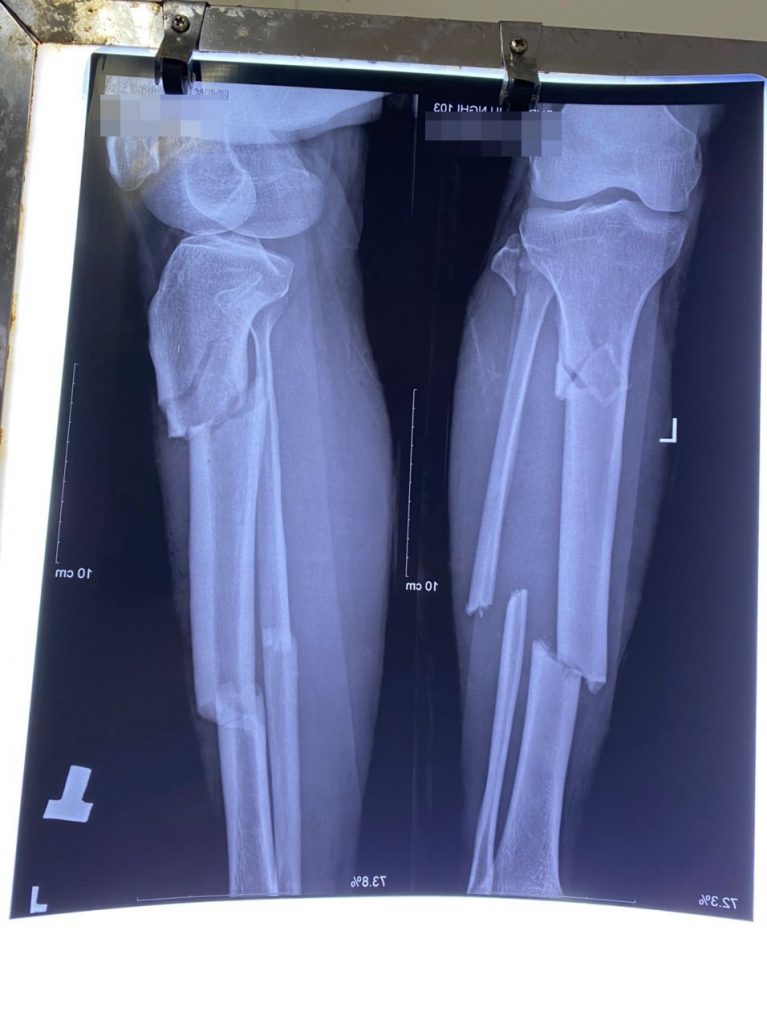 243687126 1101232080408614 5943832361364278386 N