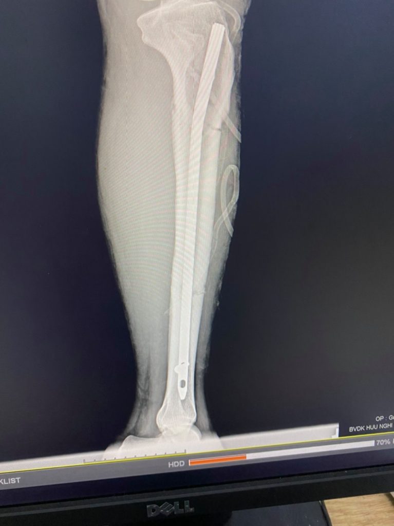 244468202 1101232067075282 2913986495405589854 N