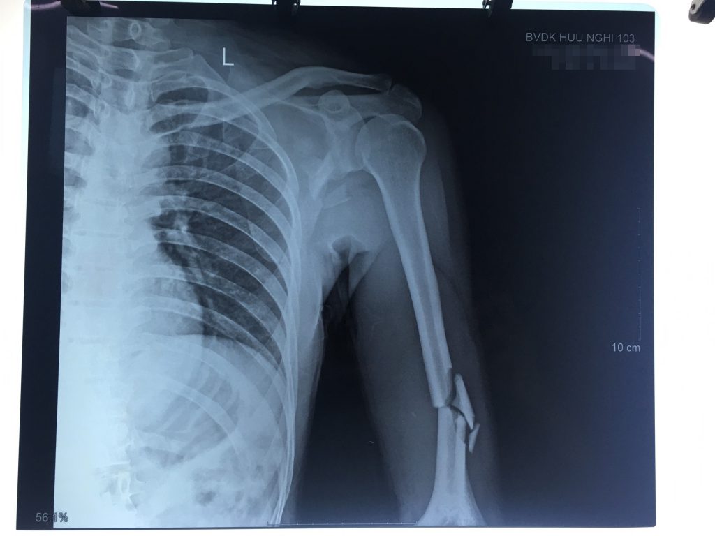 Z2844679259719 86590437aa96f8efbdf1f552770617d5