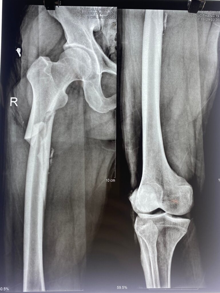 277680250 1212575299274291 3210026468575903267 N