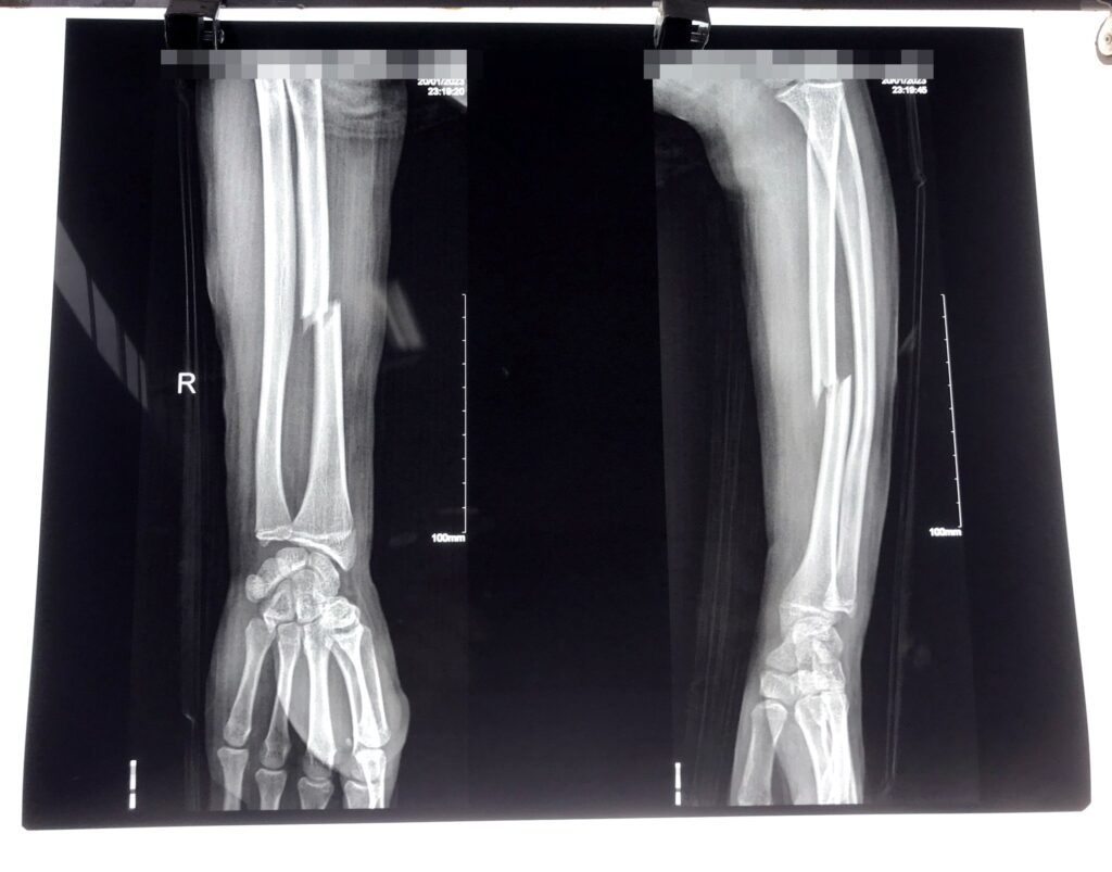 324596527 886061852515486 2029560929616593642 N