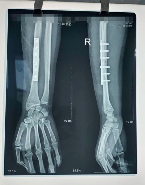 327734362 582929109930495 369255849896182622 N